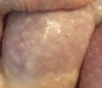 Cuisses de poulet